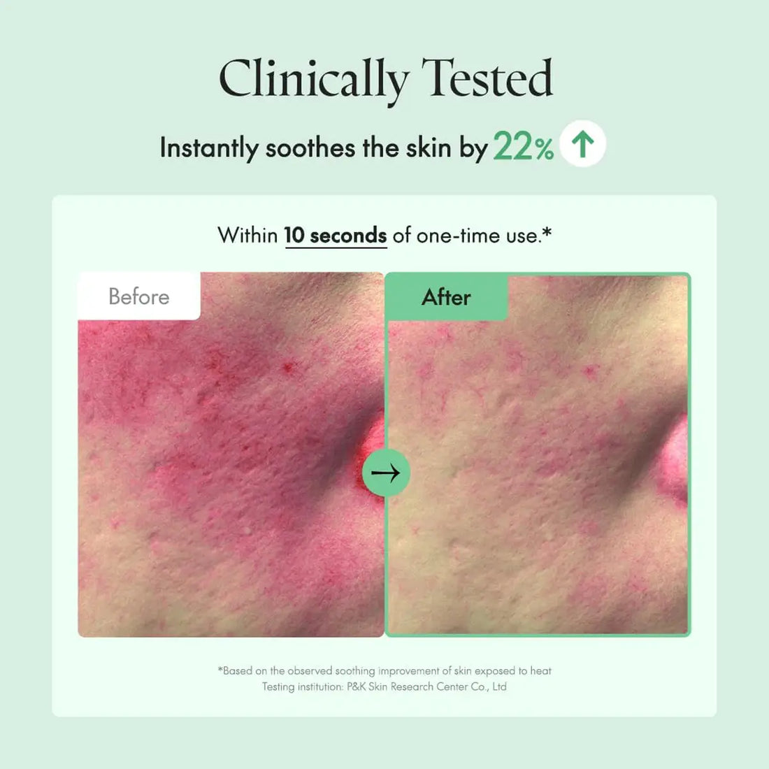 Before and after skin comparison with text indicating clinical testing and skin soothing benefits.