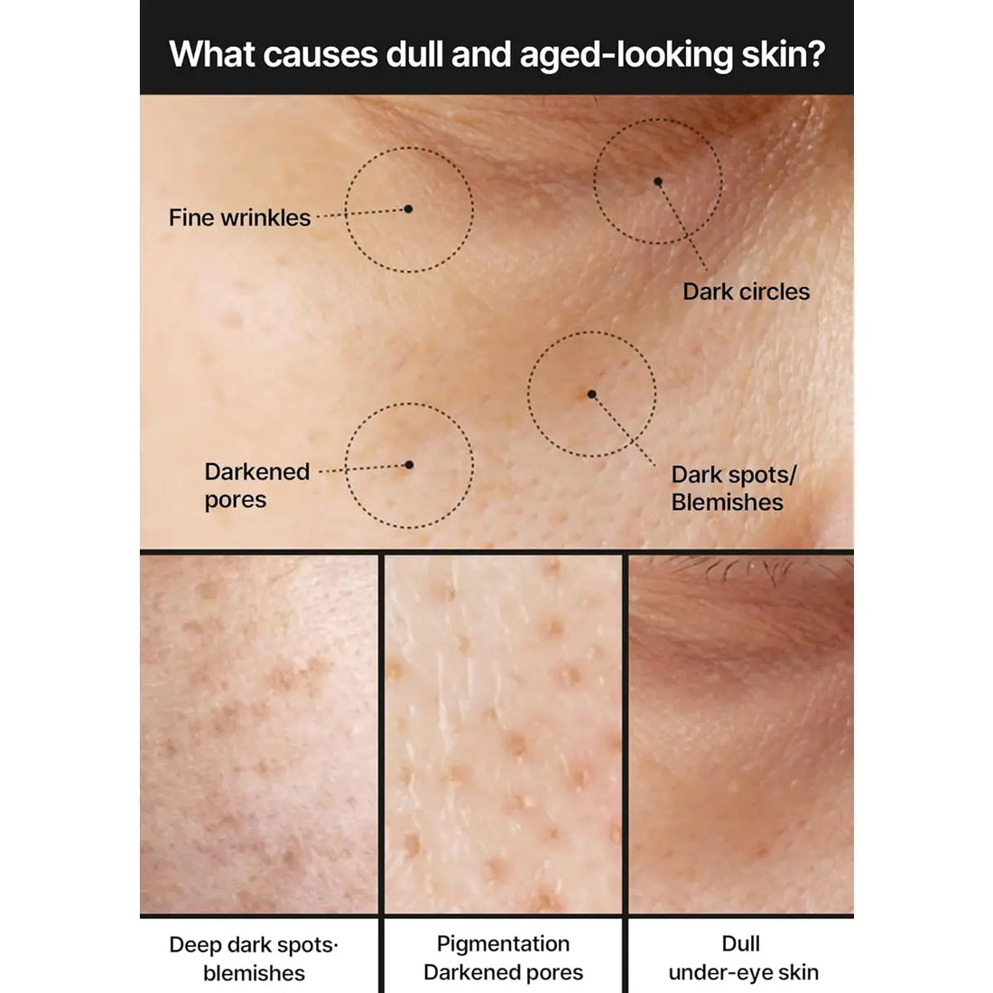 Illustration of various skin issues and their causes on a beige background.