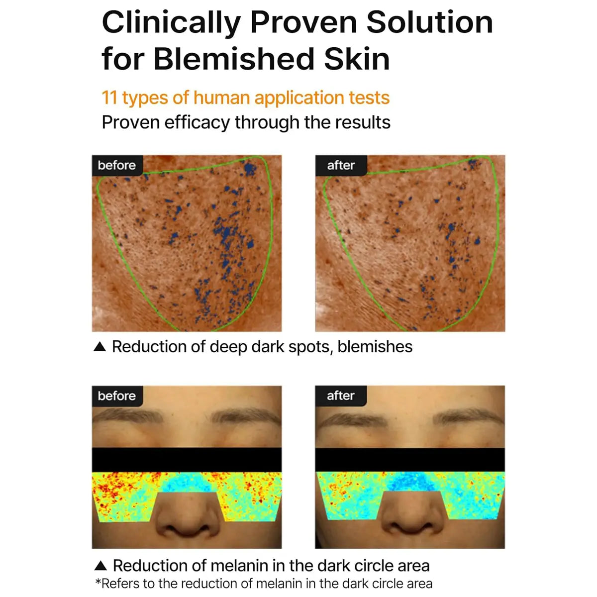 Before and after skin treatment results with text about clinically proven solution for blemished skin.