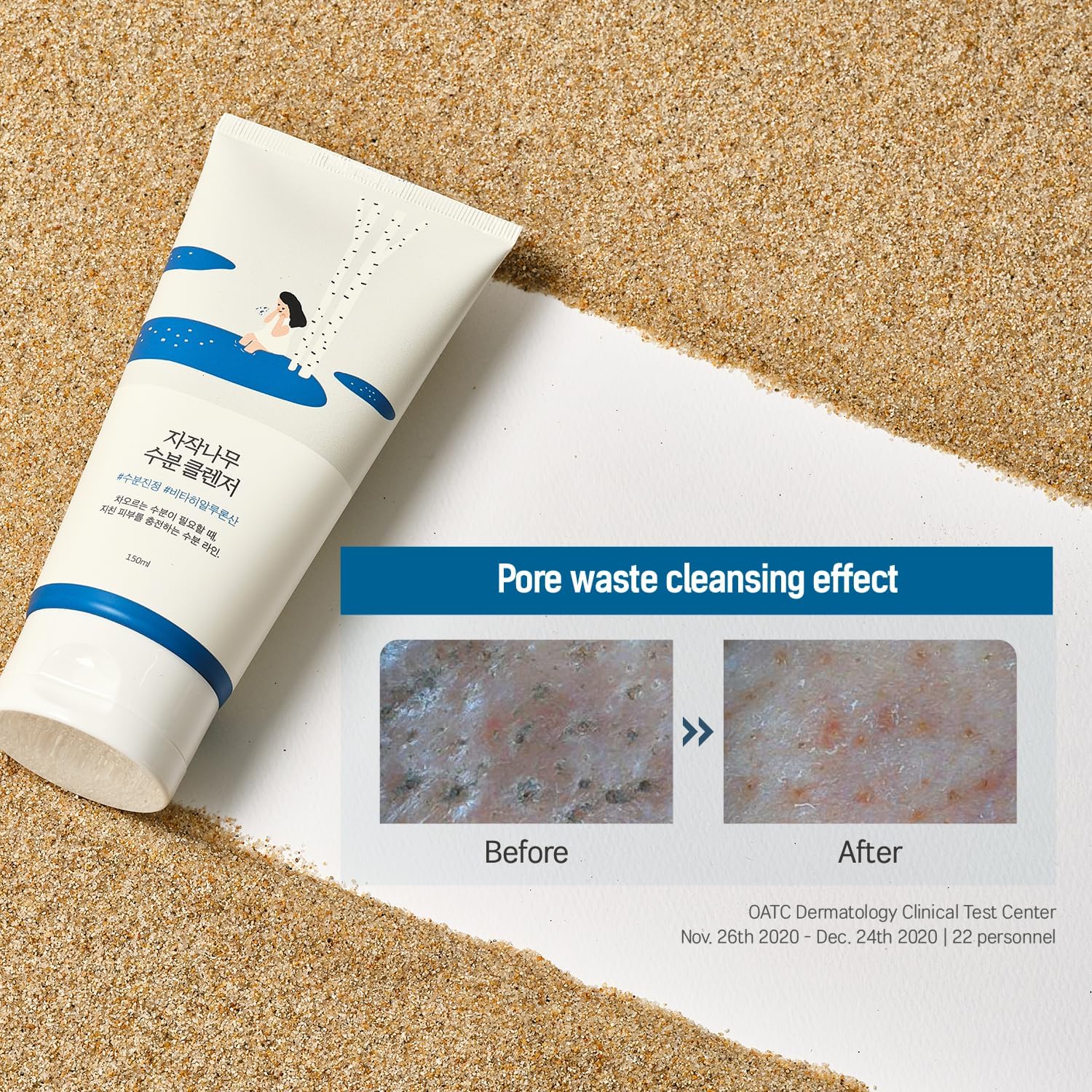 Round Lab Birch Juice Moisturising Cleanser – Korean skincare 150ml, Before & After