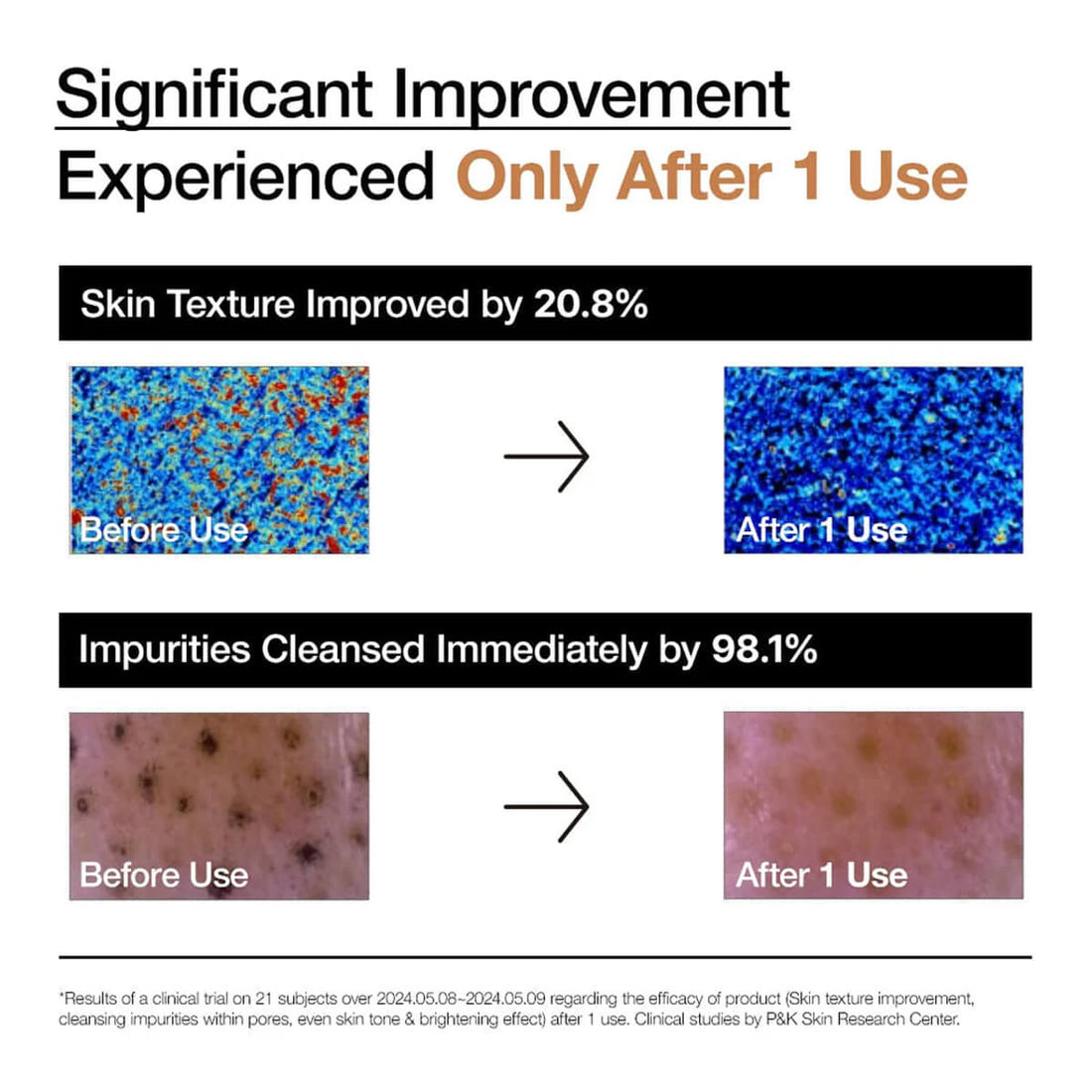 Before and after effects of a skincare product on skin texture and impurities with statistical improvement percentages.
