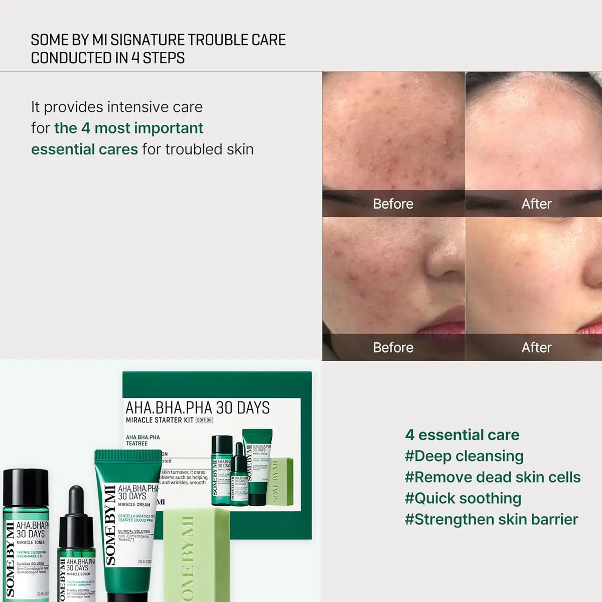 SOME BY MI AHA BHA PHA 30 Days Miracle Starter Kit showcasing before and after results of 4 essential skin cares.