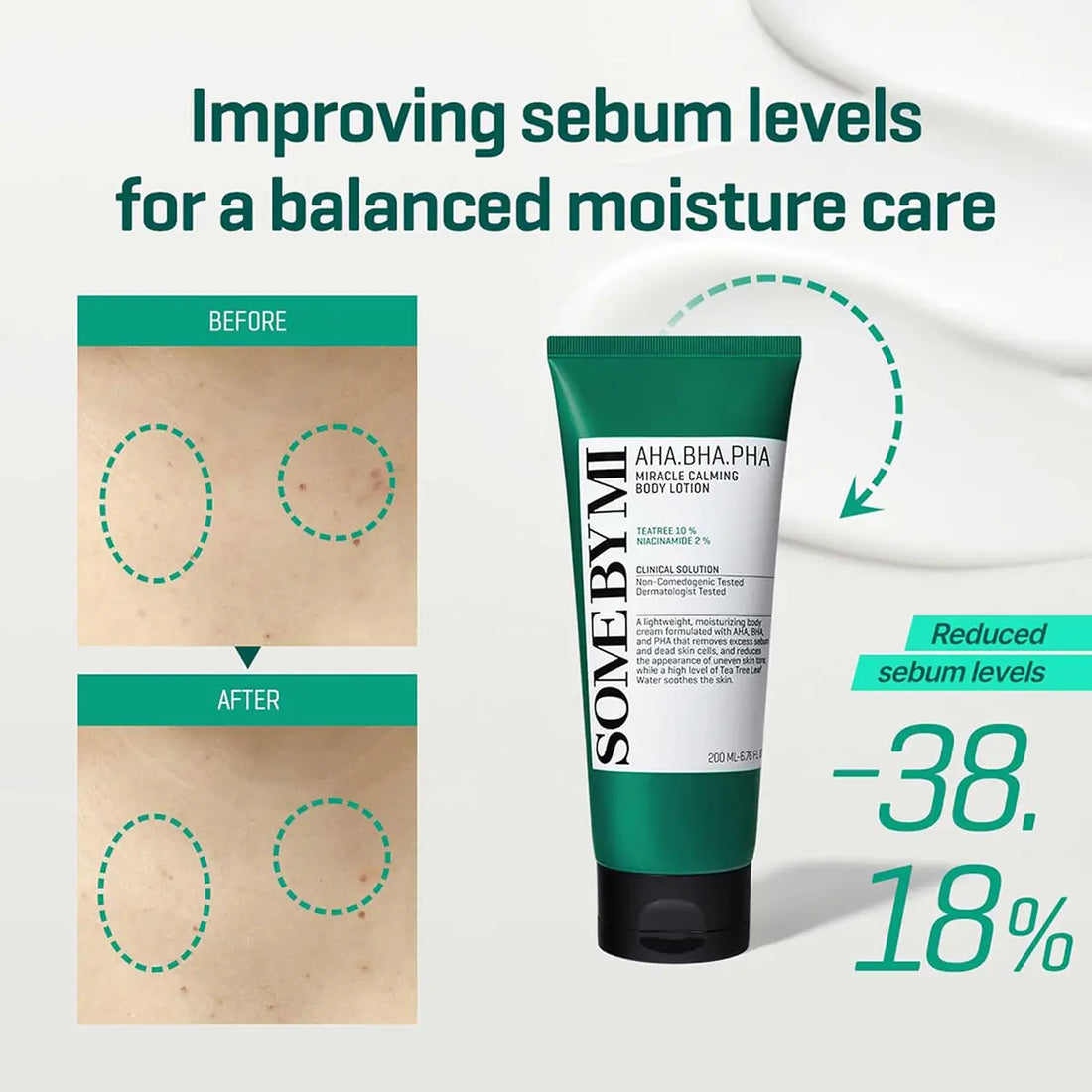 SOME BY MI AHA BHA PHA Miracle Calming Body Lotion 200mL before and after sebum improvement