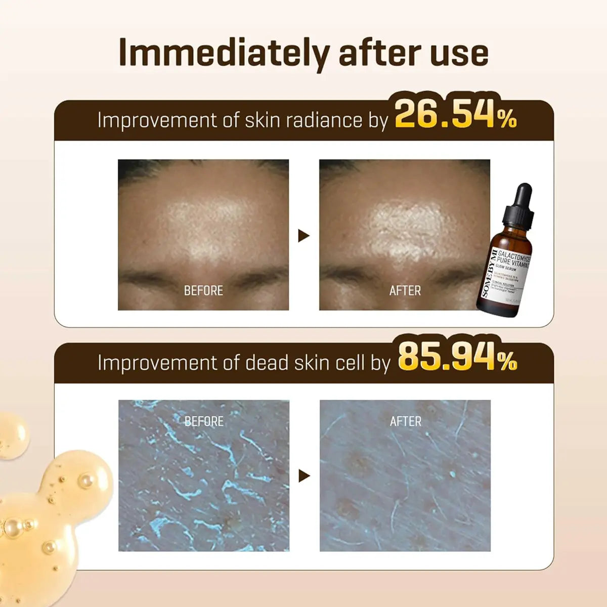Immediately after using SOME BY MI Galactomyces Pure Vitamin C Glow Serum 30mL showing 26.54% skin radiance improvement.