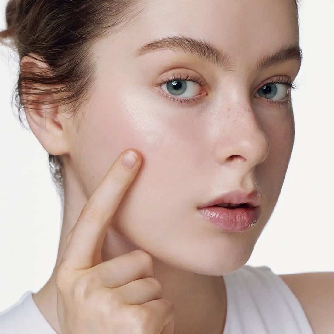 SOME BY MI Micro Pin Spot Patch 9 Pcs applied on a model's blemish for targeted acne treatment.
