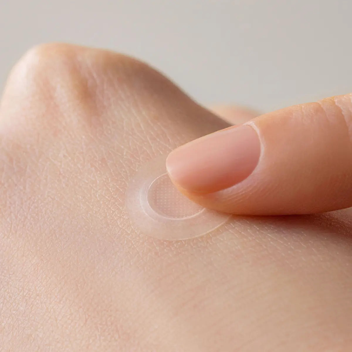 SOME BY MI Micro Pin Spot Patch 9 Pcs placed on hand for acne treatment effectiveness.