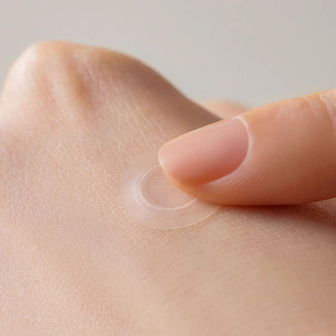 SOME BY MI Micro Pin Spot Patch 9 Pcs placed on hand for acne treatment effectiveness.