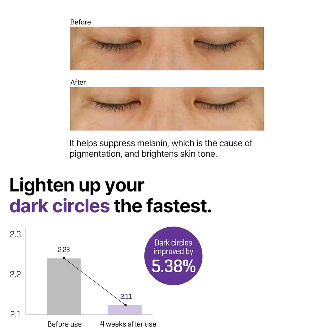 Before and after photos showing results of SOME BY MI Retinol Intense Advanced Triple Action Eye Cream 30mL on dark circles.