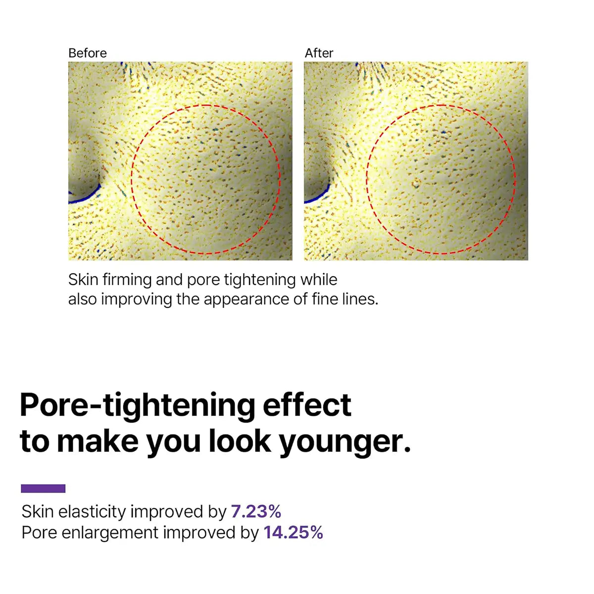 Before and after results showcasing pore-tightening effects and skin improvement from SOME BY MI Retinol Intense Advanced Triple Action Eye Cream 30mL.