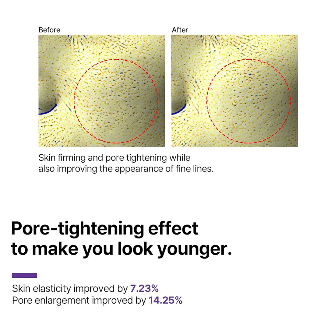 Before and after results showcasing pore-tightening effects and skin improvement from SOME BY MI Retinol Intense Advanced Triple Action Eye Cream 30mL.