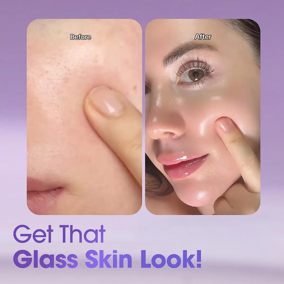 Before and after results of using SOME BY MI Retinol Intense Reactivating Serum 30mL for glass skin.