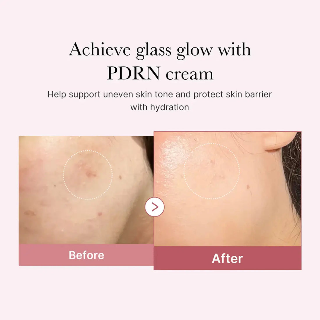 Before and after comparison of skin with PDRN cream application on a light pink background.