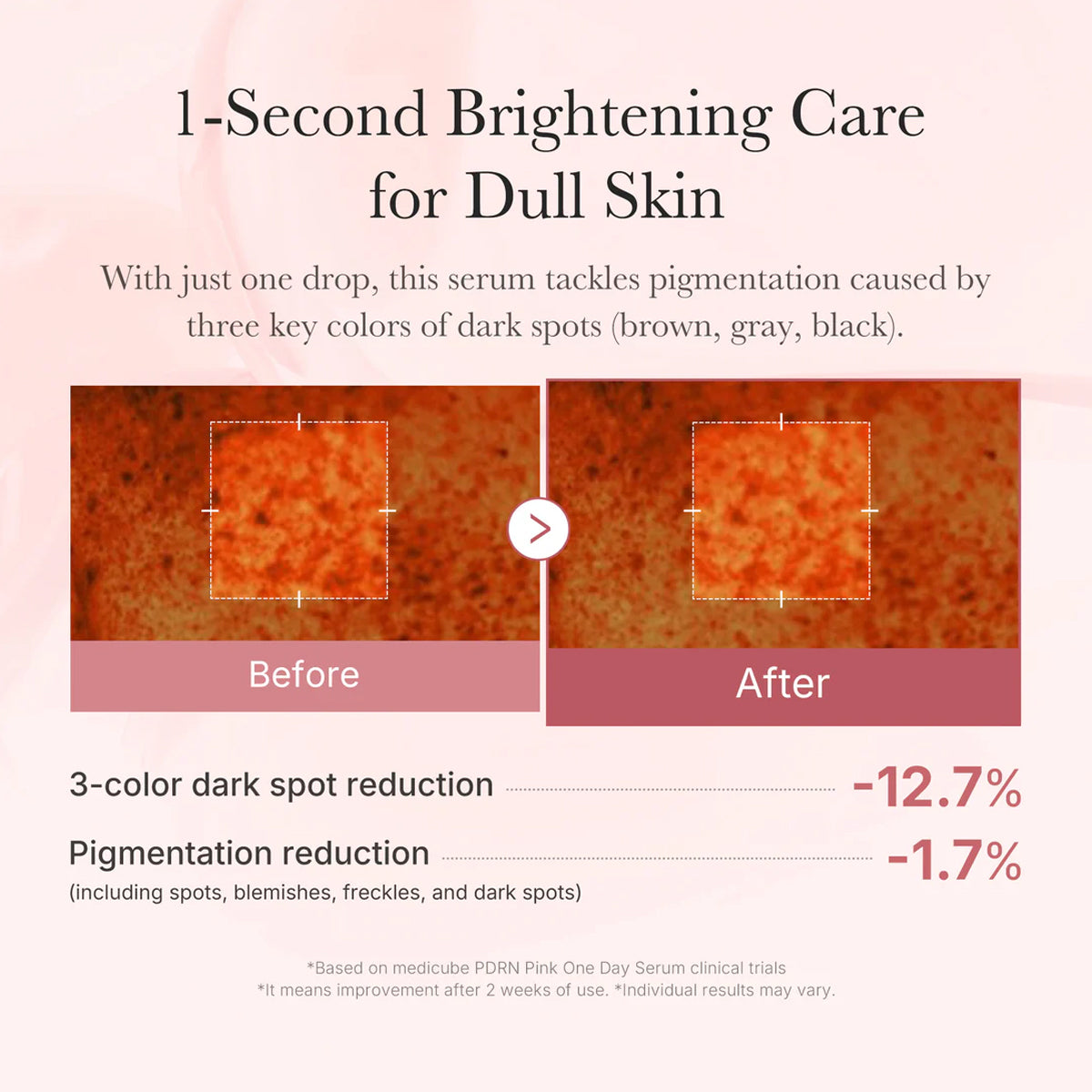 Medicube Salmon PDRN Pink One Day Serum care for dull skin