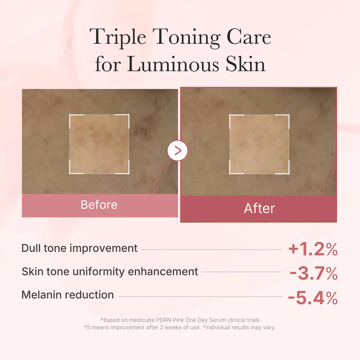 Before and after comparison of skin tone improvement with text on a pink background
