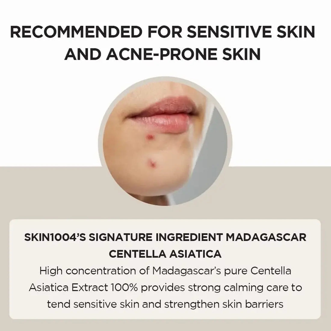 Skin1004 Madagascar Centella Ampoule recommended for Acne-Prone skin