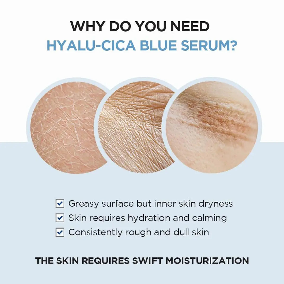 Why do we need Skin1004 Madagascar Centella Hyalu-Cica Blue Serum
