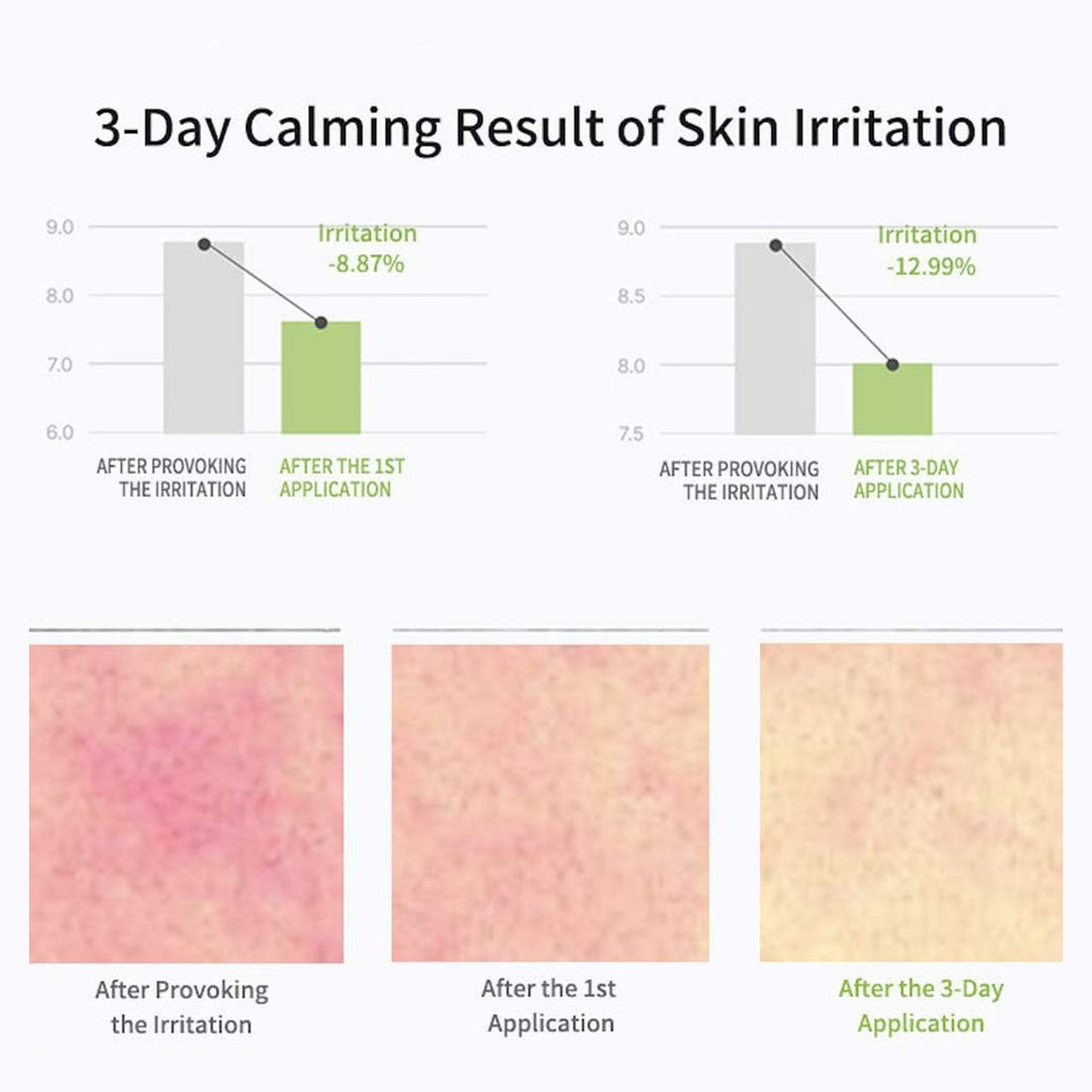 3-Day Calming Result of Skin Irritation with graphs and skin texture images.