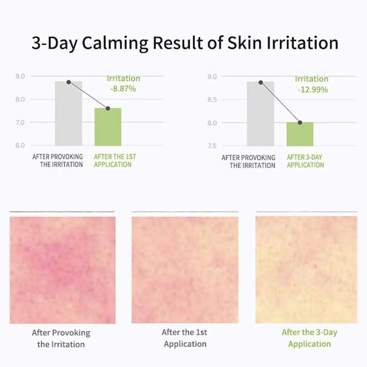 Graph and skin irritation before-and-after images showing a 3-day calming result.
