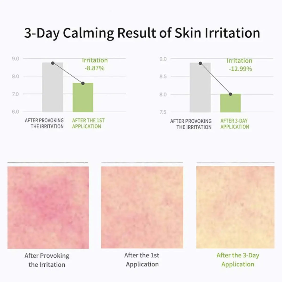 Graph and skin irritation before-and-after images showing a 3-day calming result.