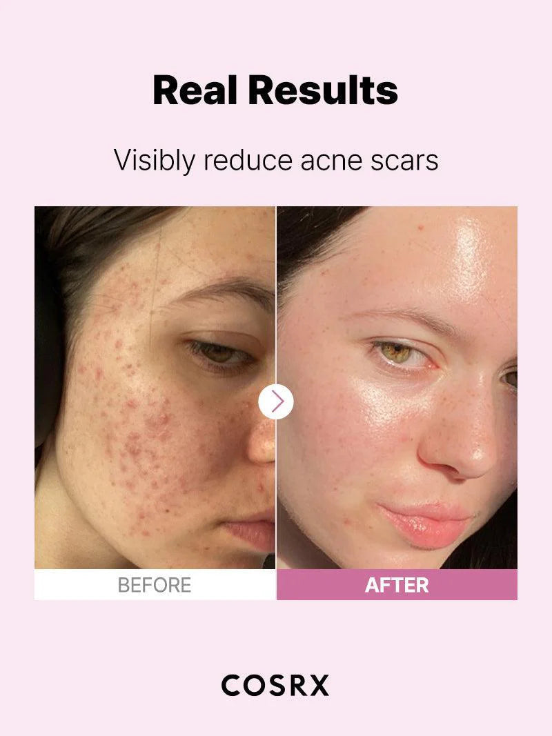 The Niacinamide 15 Serum (20g)