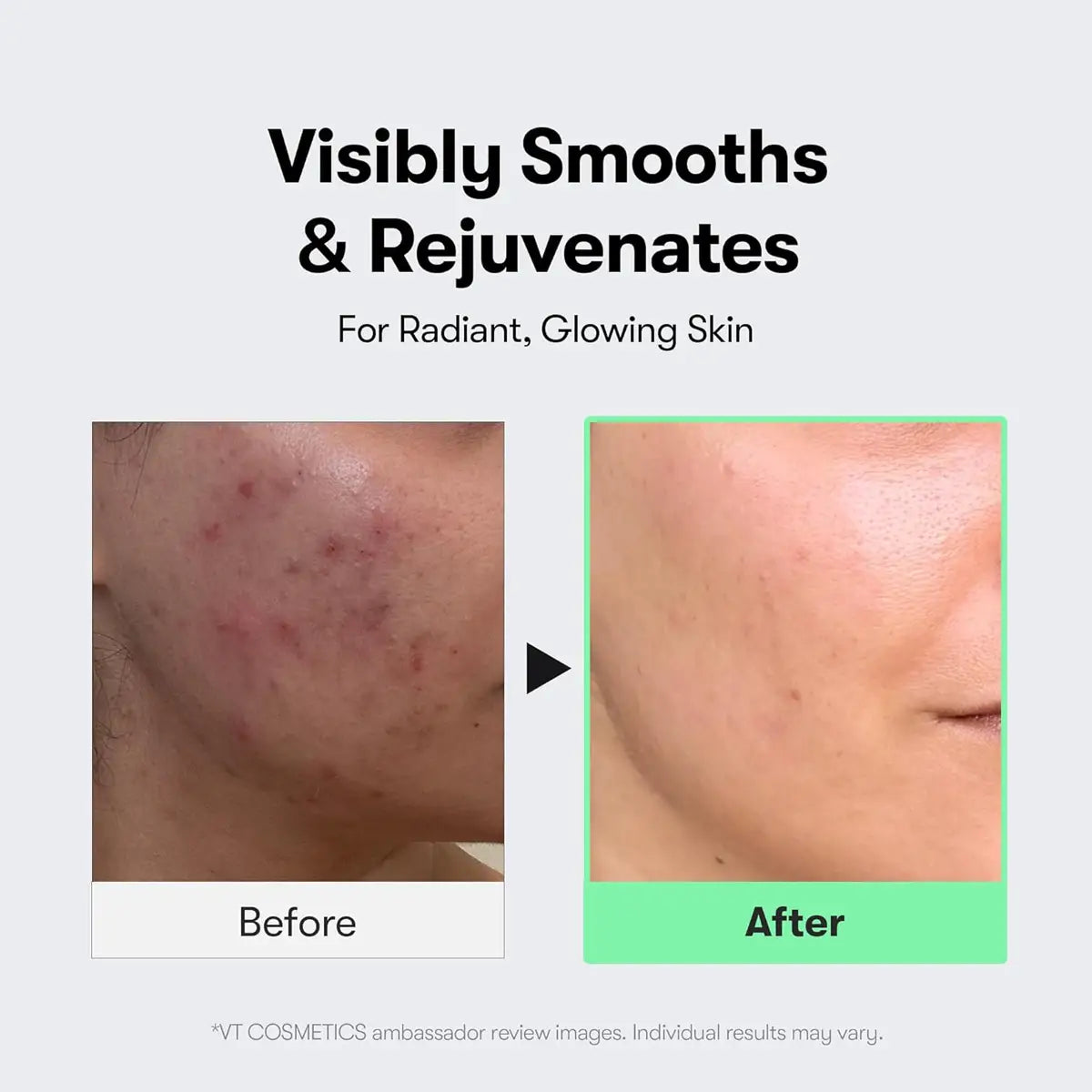 VT REEDLE SHOT 300 50mL before and after skincare results showing visibly smoother and rejuvenated skin.
