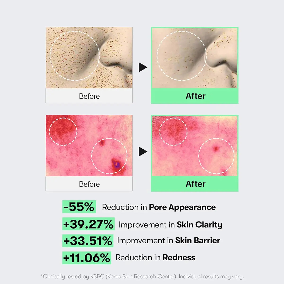 VT REEDLE SHOT 300 50mL before and after results showing significant skin improvements.