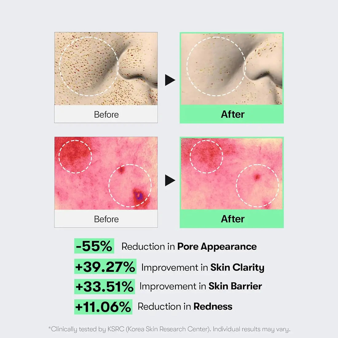 VT REEDLE SHOT 100 50mL before and after results showing improved skin clarity and reduced redness