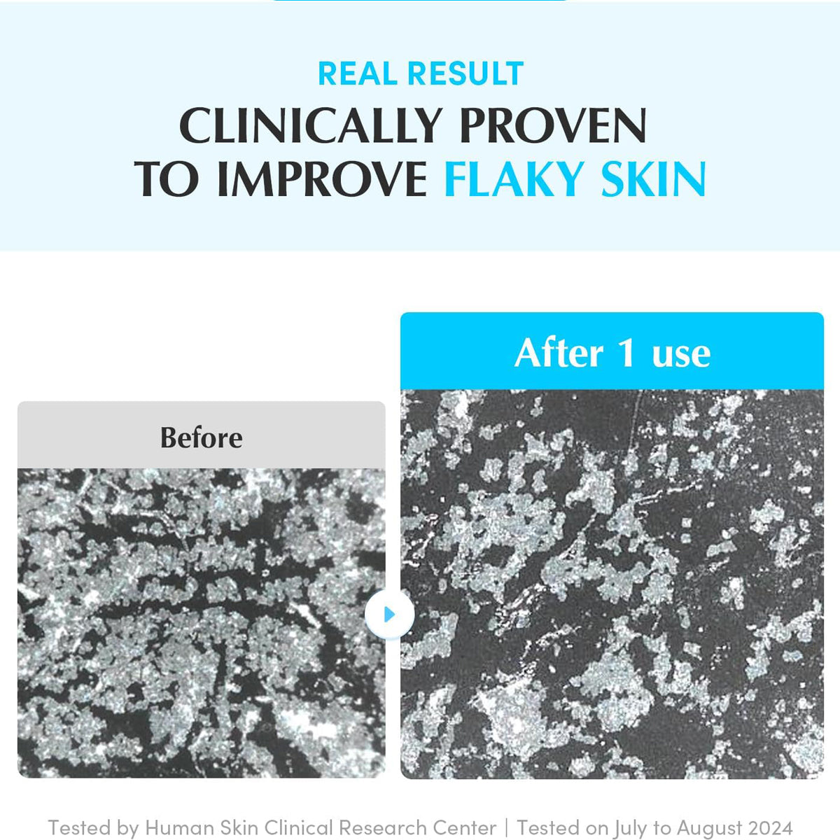 EQQUALBERRY Vegan Swimming Pool Toner Pads – Korean hydrating toner pads for dry and sensitive skin. Usage