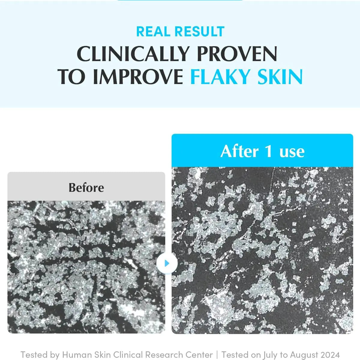 Before and after comparison of flaky skin improvement with text indicating clinical proven results.