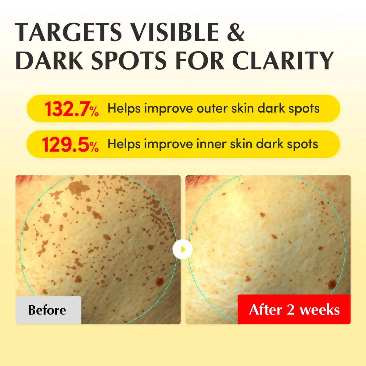 Before and after comparison of skin dark spots with text highlighting product effectiveness.