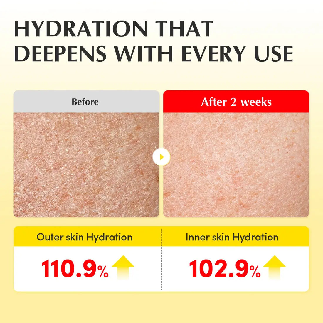 Before and after comparison of skin hydration with text 'Hydration that deepens with every use' on a yellow background.