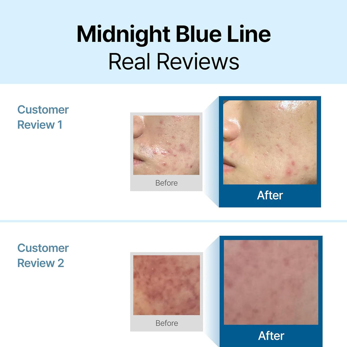 Before and after skin comparison with 'Midnight Blue Line' branding