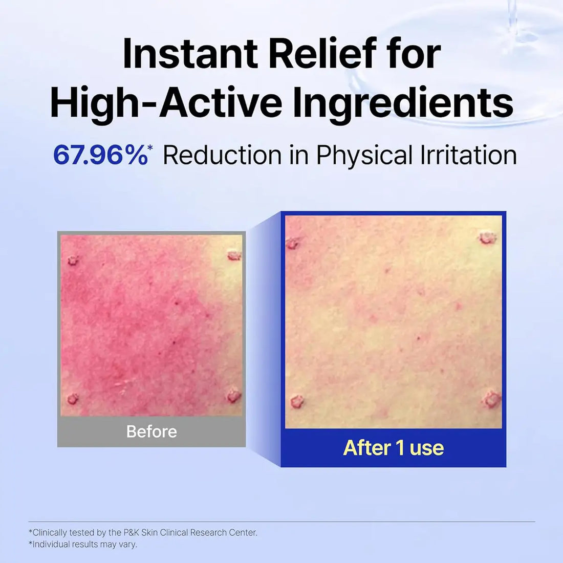 Before and after comparison of skin irritation with text about high-active ingredients and reduction in physical irritation.
