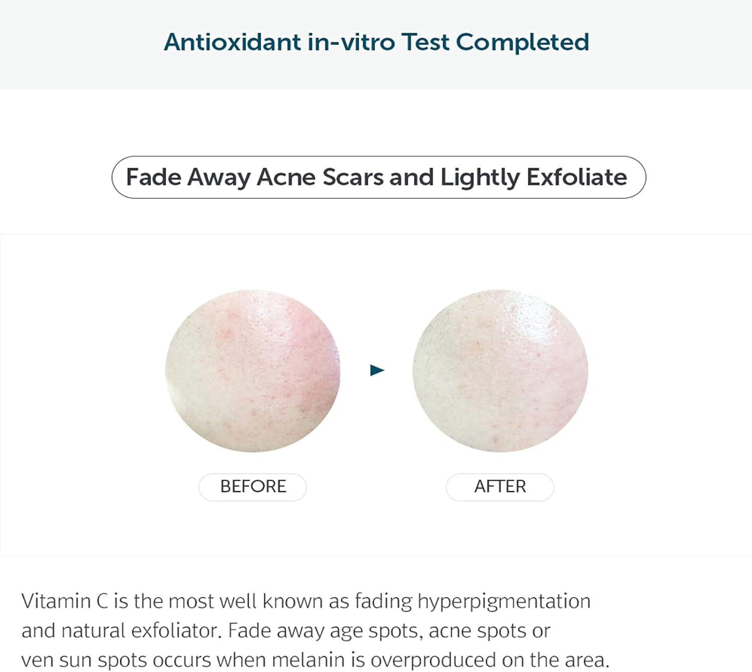 dear Klairs Freshly Juiced Vitamin Drop 35mL | Korean Vitamin C serum for glowing and blemish-prone skin in UAE. Before & After