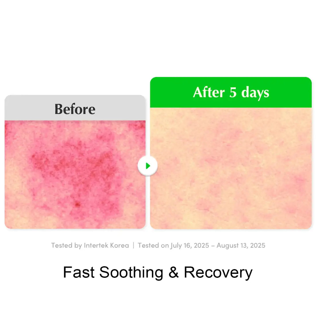 Before and after comparison of skin condition with Intertek Korea testing on a white background