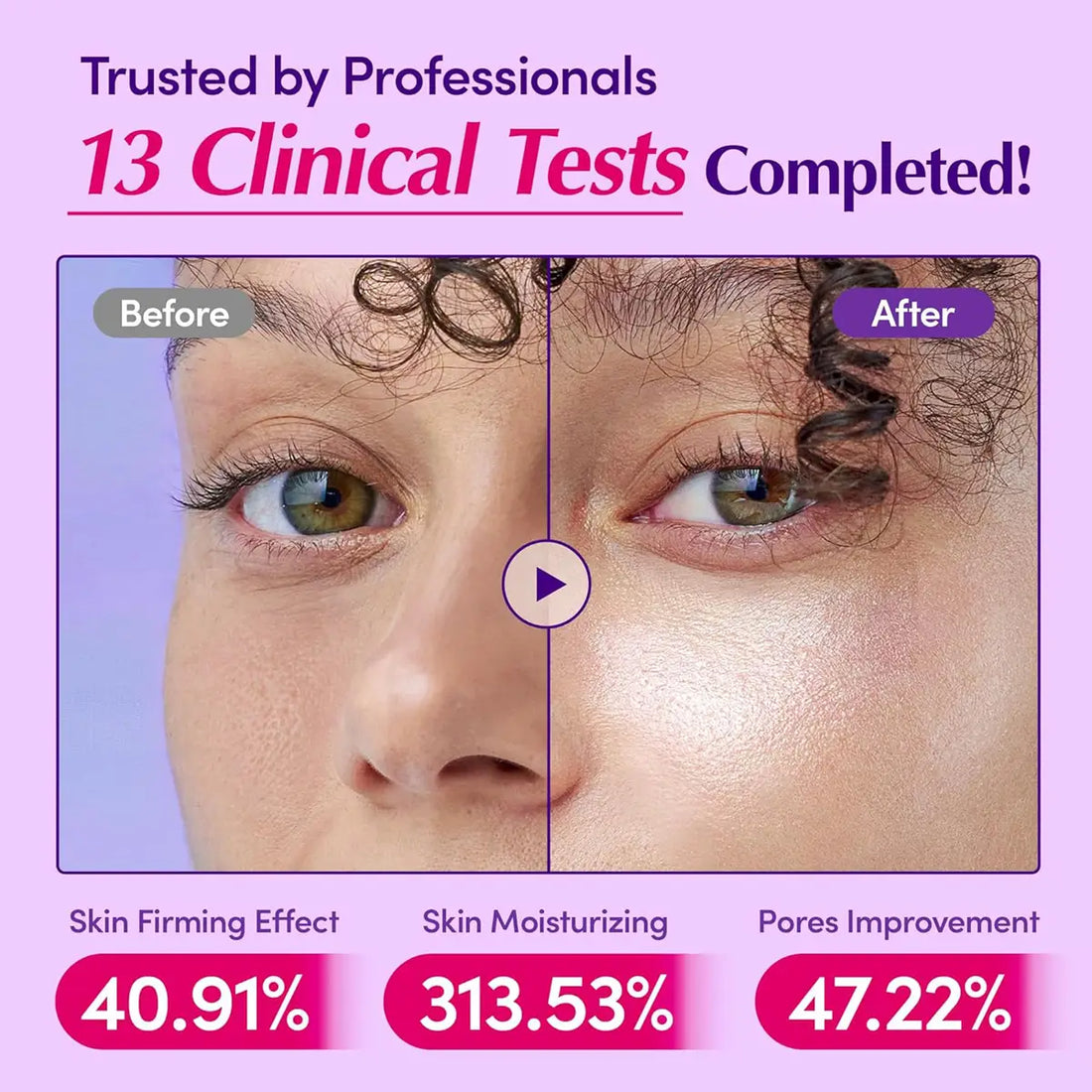 Before and after comparison of skin treatment with clinical test results on a purple background