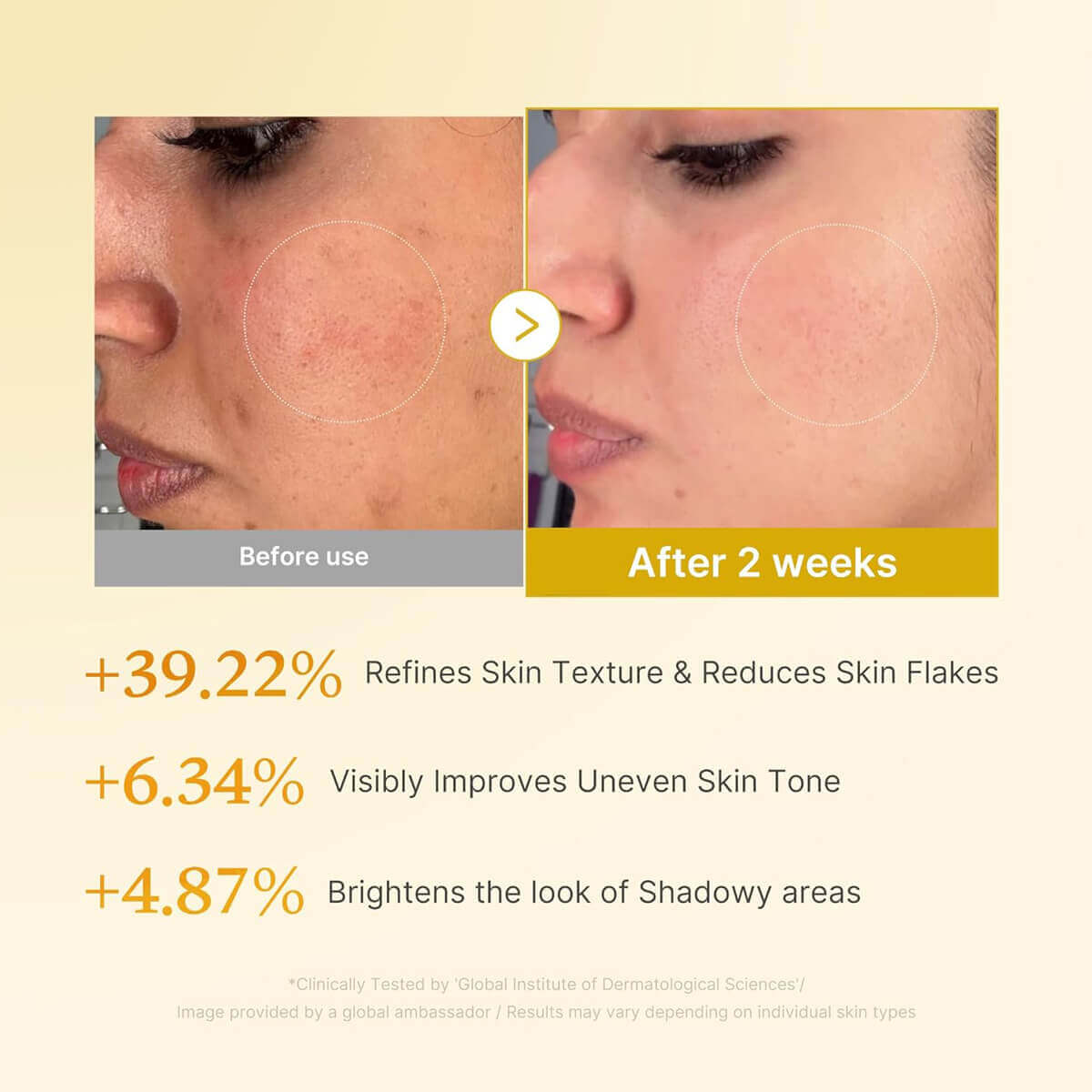 Before and after results of Kojic Acid Turmeric Resurfacing Toner, showing improved skin texture and tone.
