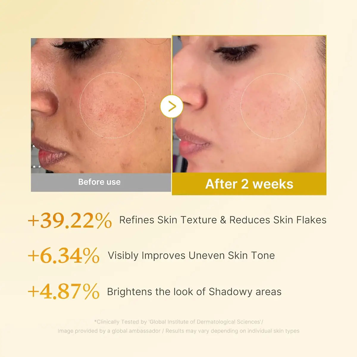 Before and after comparison of skin texture with text highlighting improvements.